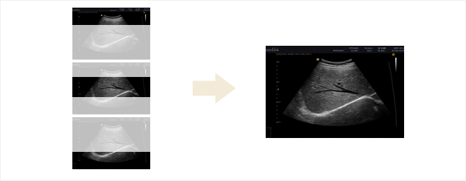 Az optimalis mélységek egyesítés - Full Spectrum Imaging képalkotás a műtermékmentes kép érdekében Az optimalis mélységek egyesítés - Full Spectrum Imaging képalkotás a műtermékmentes kép érdekében