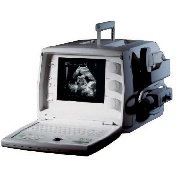 SonoAce 600